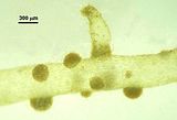 Dettaglio dei glomeruli di filamenti assimilatori secondari